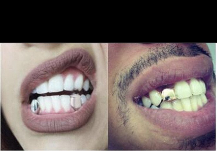 Gold Grillz Mouth Teeth, Hip Hop Teeth Plain , Top Tooth Single Grill Cap