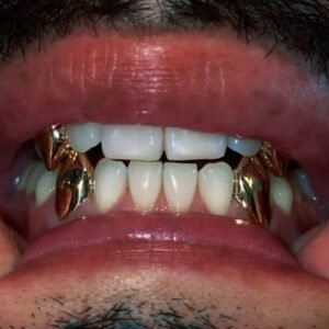Unisex Gold Grillz Fangs Set OF 4