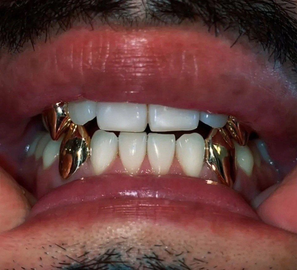 Unisex Gold Grillz Fangs Set OF 4